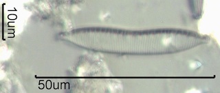 Hantzschia amphioxys